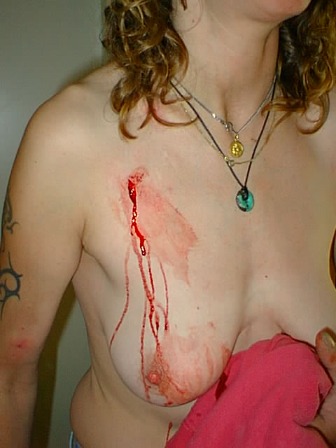 Gewalt gegen Frauen - Messerstich